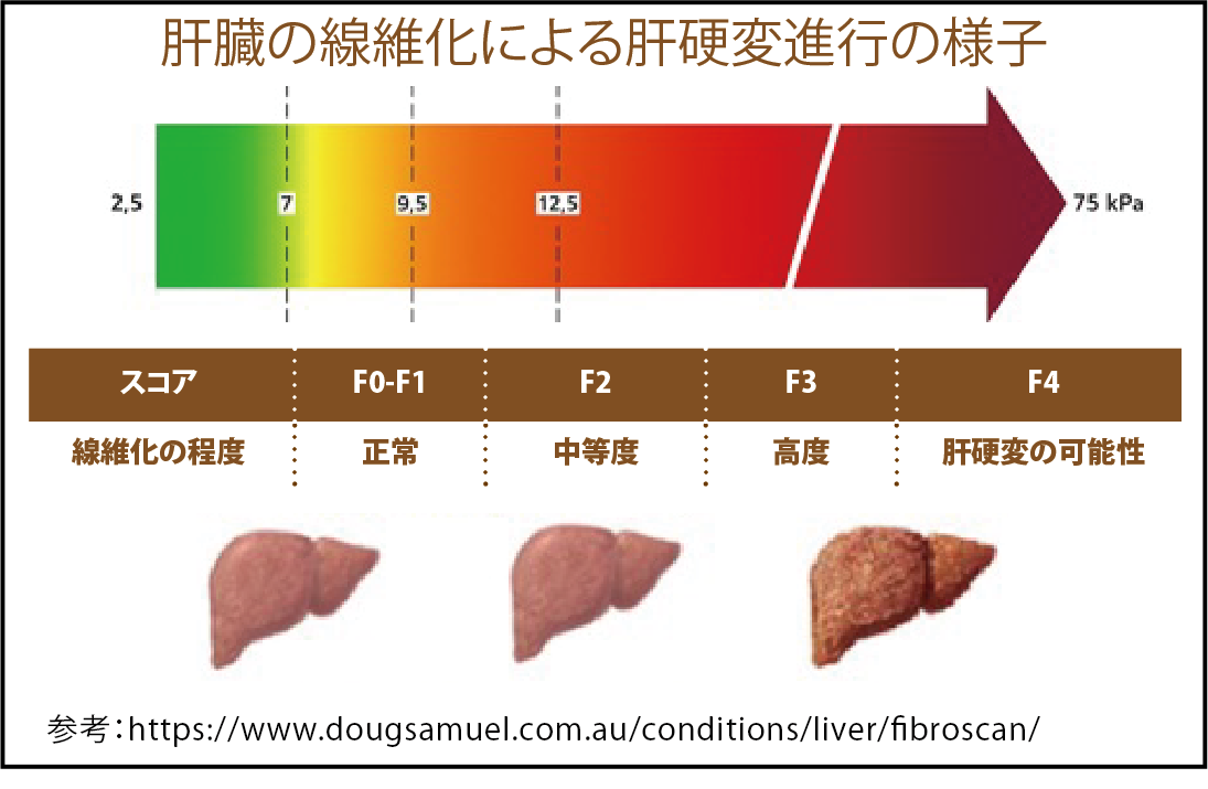 754848d173d4f58fda5f99bec8e9796d-1759148854.png